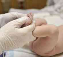 Hipertonia musculară la nou-nascuti
