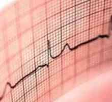 Pasiune Heartfelt. Cele mai frecvente modificări ECG detectate în timpul sarcinii