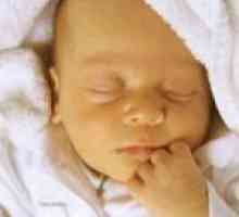 Simptomele de icter la nou-născuți