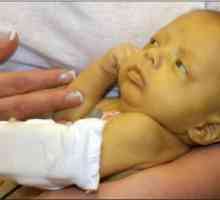 Icter într-un copil nou-născut și tratamentul acestuia