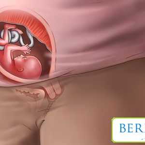 Urinare frecventă în timpul sarcinii