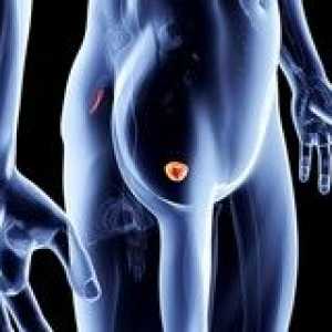 Cancerul de prostata - Simptome si prognosticul de supravietuire