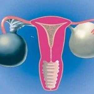 Ruperea chisturi ovariene - simptome, efecte și tratament