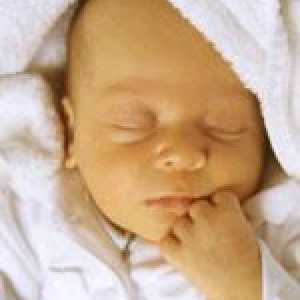 Simptomele de icter la nou-născuți