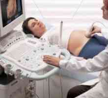 33 De săptămâni de sarcină: ultrasunete