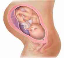 35 Săptămâni gravidă: prezentare pelviana