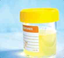 Acetona în urină în timpul sarcinii