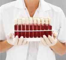 Analiza sângelui pentru determinarea grupului sangvin