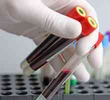 Transcrierea test de sange