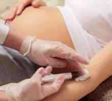 Un test de sânge pentru gravide