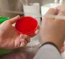 Analiza urinei pentru însămânțare