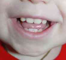 Pete albe pe dinții unui copil