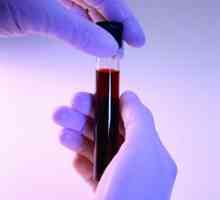 Analiza biochimică a sângelui în dim