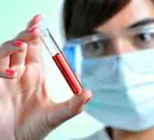 Analiza biochimică a sângelui pentru fier