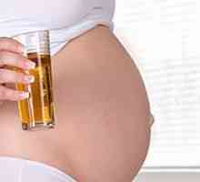 Durere la nivelul vezicii urinare in timpul sarcinii