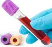 Teste Cdat pentru hepatita