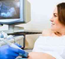 Ce poate fi vazut la ecografie la 32 de săptămâni de sarcină?