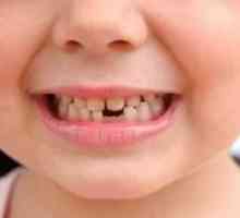 Ce trebuie să știți despre dinți primari la copii?