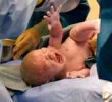 Daune perinatală a sistemului nervos la nou-nascuti (pptsns)