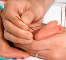 Ce este screening-ul nou-născuților, precum și atunci când se efectuează