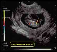 Ecografia Doppler în timpul sarcinii
