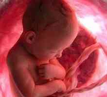 Artera ombilicală unică în timpul sarcinii, pentru a înțelege cauzele anomalia