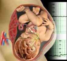 Sistemul fetoplacentare (FPS). insuficiență placentară