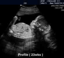 Fotografii cu ultrasunete 22 de săptămâni gravidă