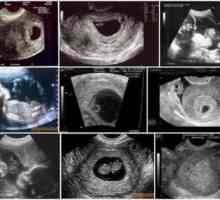 Fotografie de săptămâni de sarcină cu ultrasunete