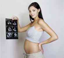 Fotografii cu ultrasunete 20 de săptămâni gravidă