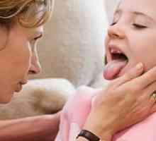 Herpes durere în gât la copii - simptome ale bolii și modalități de ao trata. Sfaturi de la medici…
