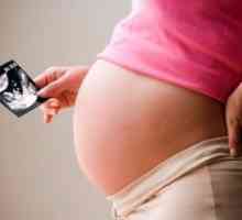 Hidronefroză în timpul sarcinii