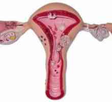 Hiperplazie endometrială