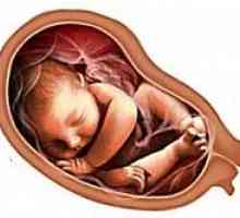 Hipoxie fetală