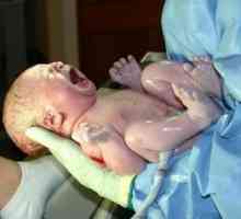 Hipoxia la nou-născuți - o stare periculoasă