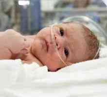 Hipoxia la nou-născuți: cauze, simptome și tratament