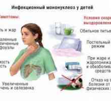 Mononucleoza infecțioasă la copii: simptome si tratament