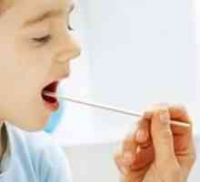 Mononucleoza infecțioasă la copii
