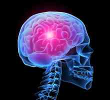 Accident vascular cerebral - Simptome si tratament