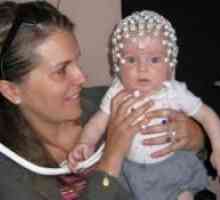 Brain EEG la copii
