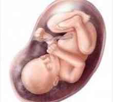 După cum este stabilit de perturbație: cum este copilul în uter