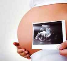 Cum de a identifica sindromul Down în timpul sarcinii