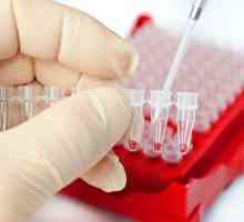 Cum să luați un test de sânge pentru HCG