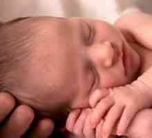 Chist la nou-nascuti: cauze, simptome și tratament