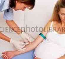 Coagulare în timpul sarcinii (hemostasiogram)