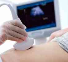 Când aveți nevoie pentru a face ecografie în timpul sarcinii: recomandările experților