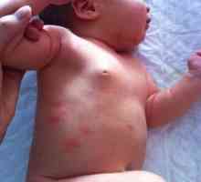 Bolile de piele la copii care nu au nevoie să fie tratate