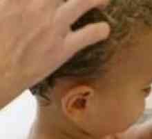 Tratamentul dermatitei seboreice la copii
