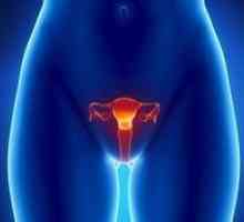 Metode de tratare a cancerului de col uterin