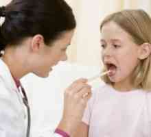Mononucleoza la copii: simptome si tratament